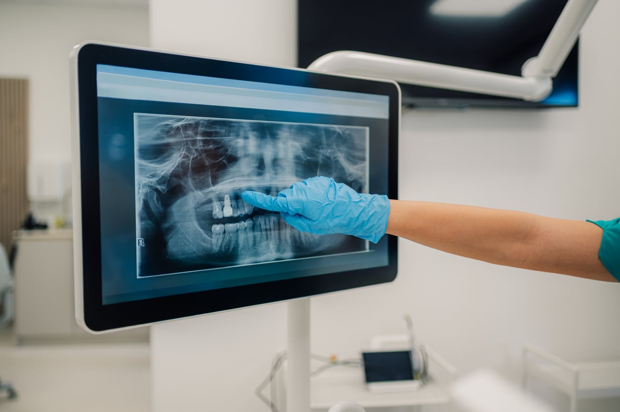 X-Ray Types at The Dental Spa